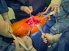 Retractor muscular DAA