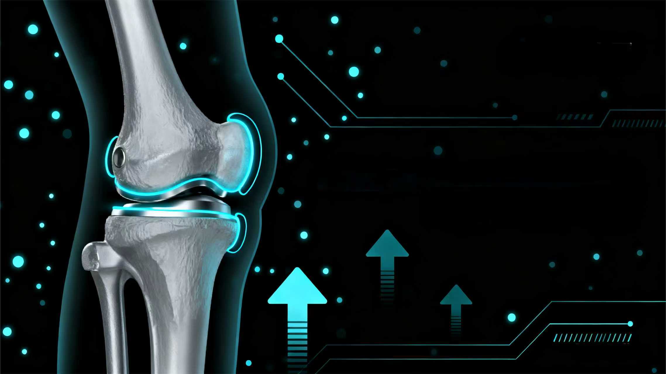 ¡Cirugía de reemplazo de rodilla con precisión! El juego de instrumentos quirúrgicos TKA-CW de Shandong Liangyi hace su gran debut Descubra una nueva experiencia quirúrgica TKA, respaldada por instru